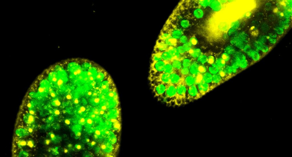 Fluorescence microscopy image of Paramecium bursaria showing Chlorella spp. algal symbionts in green