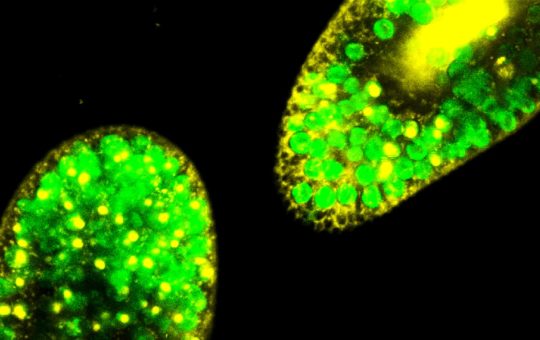 Fluorescence microscopy image of Paramecium bursaria showing Chlorella spp. algal symbionts in green