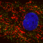 Researchers discover new way cells protect themselves from damage