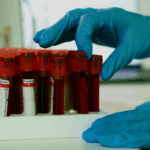 Anaemia, ethnicity, and cancer incidence: a retrospective cohort study in primary care