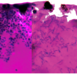 Revealed: genetic process which could be treatment target for deadly fungal disease Candida auris