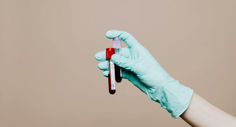 Cancer blood test detection research rolls out to 60 practices in Devon ...